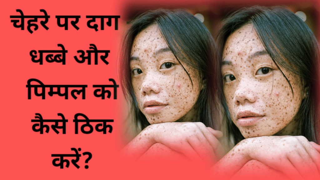 चेहरे के दाग-धब्बे और पिम्पल कैसे हटाए