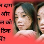 चेहरे के दाग-धब्बे और पिम्पल कैसे हटाए