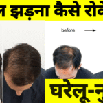 झड़ना कैसे रोके घरेलू- नुस्खे बताएं है ( hair fall )