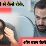 बाल झड़ने से कैसे रोकें और बाल कैसे झाड़ता है? जबरदस्त तरीके बताएं
