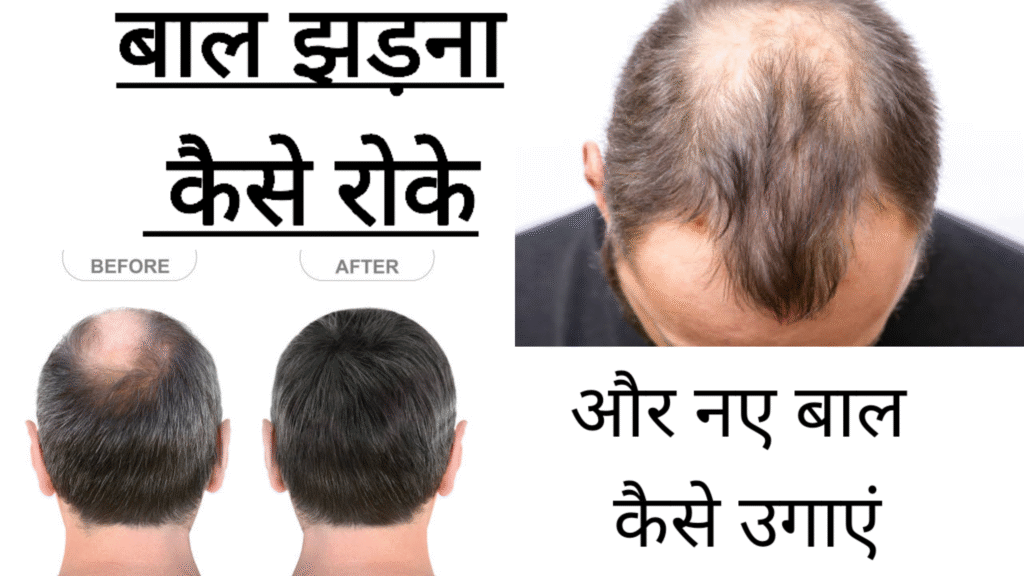 बाल झड़ना कैसे रोके और नए बाल कैसे उगाएं