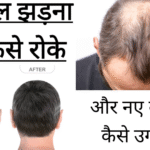 बाल झड़ना कैसे रोके और नए बाल कैसे उगाएं