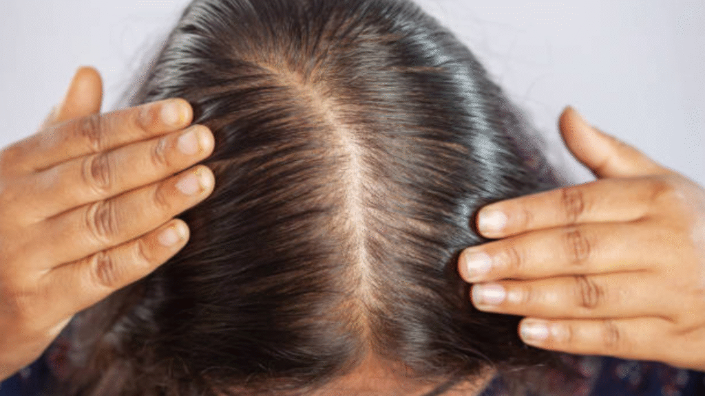पहले से कमजोर बाल और हेयर फॉल की समस्या