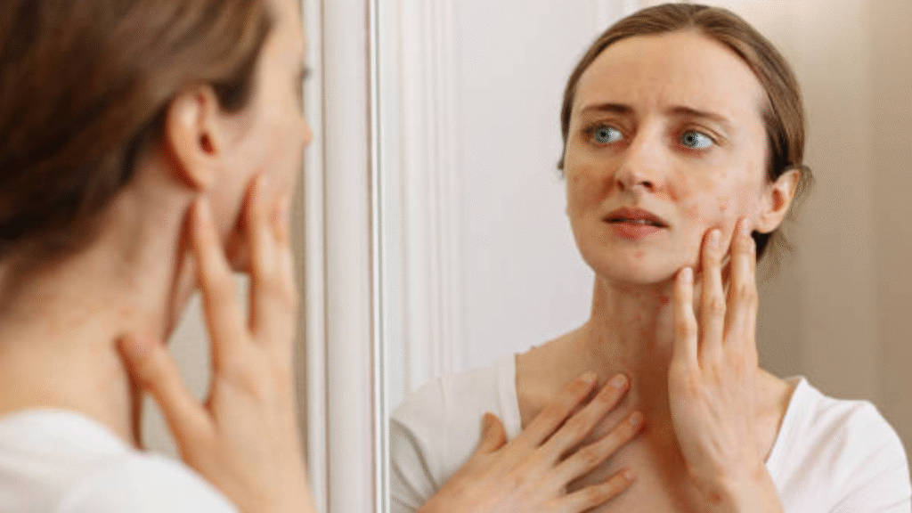 ड्राई स्किन के आम लक्षण