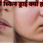 ठंड में स्किन ड्राई क्यों होते है? best कारण, लक्षण और उपाय बताइए है