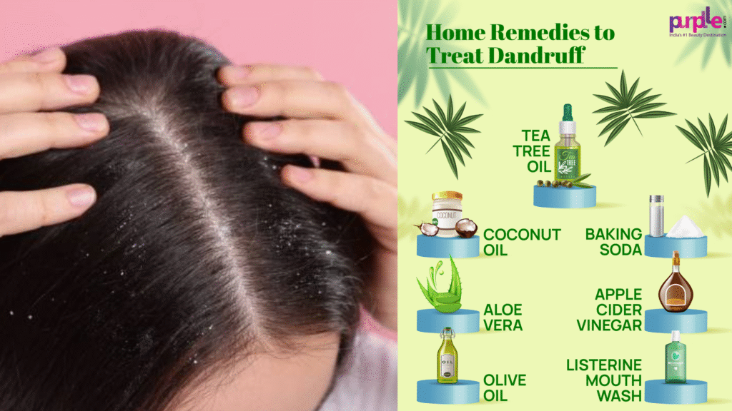 डैंड्रफ दूर करने के प्रभावी घरेलू उपाय
