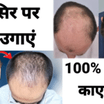 गंजे सिर पर नए बाल कैसे उगाएं? जानें 100% काम आने वाले best उपाय और घरेलू नुस्खे